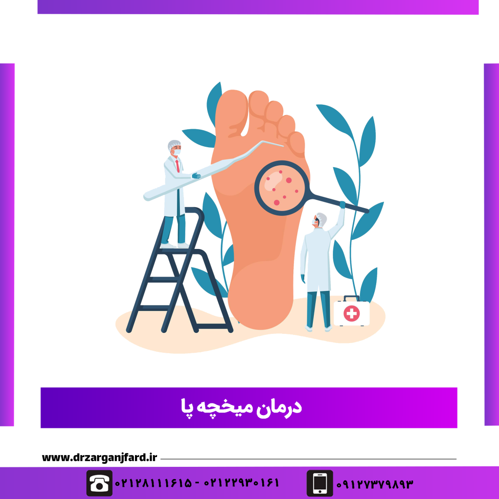 درمان میخچه پا